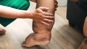 Magic wallet +27735670215 and Rings specialized spell services, including fertility spells and love spells designed to remove obstacle. picture