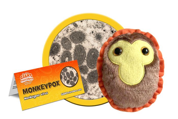 Monkeypox (Mpox Virus) picture