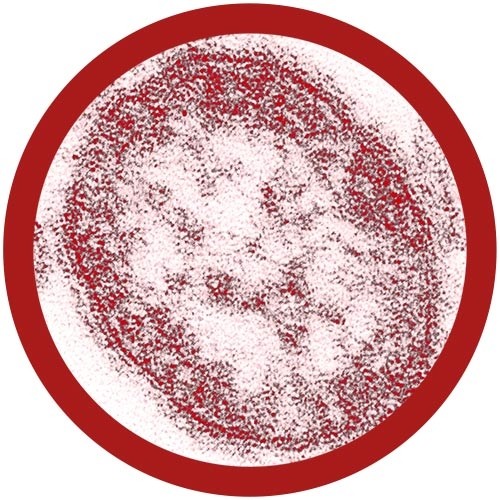 Measles (Morbillivirus) picture