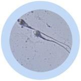 Sperm Cell (Spermatozoon) picture