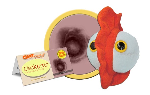 Chickenpox (Varicella-Zoster Virus)