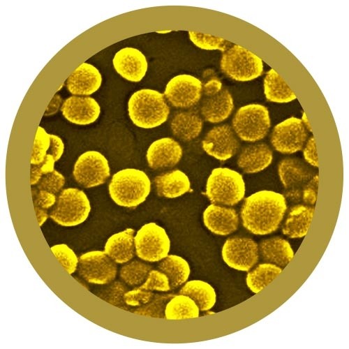 MRSA (Methicillin-Resistant Staphylococcus Aureus) picture