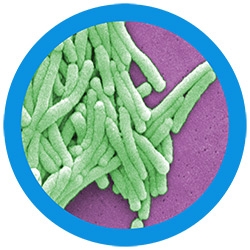Legionnaires' Disease (Legionella Pneumophila) picture
