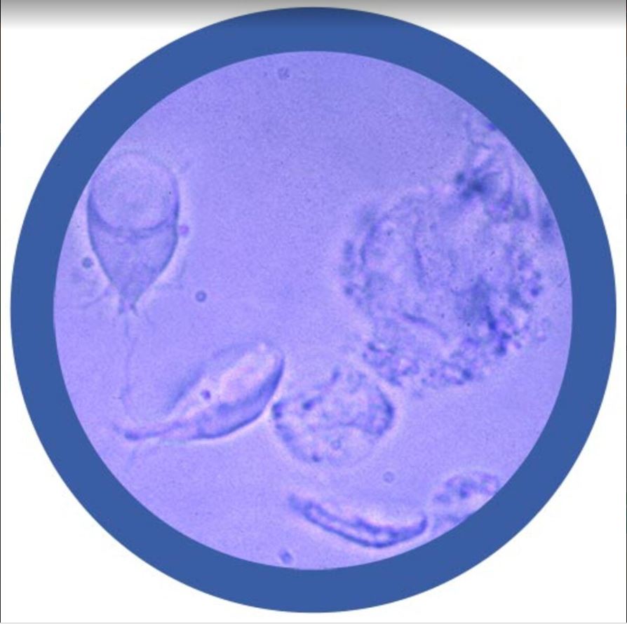 Giardia (Origional) picture