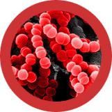 Sore Throat (Streptococcus) picture