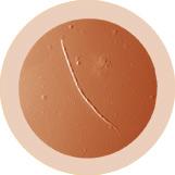 Heartworm (Dirofilaria Immitis) picture