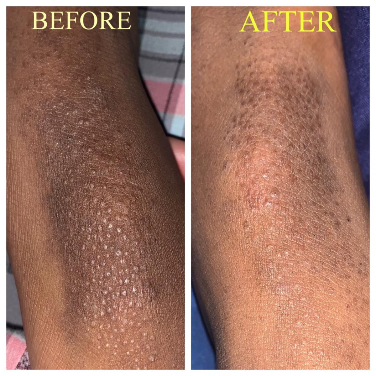 Herbal Salves picture