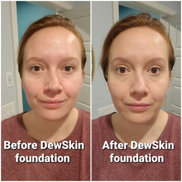 Dew Skin Tinted Moisturizer picture