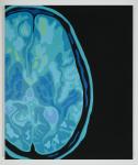 "fMRI" Acrylic Painting