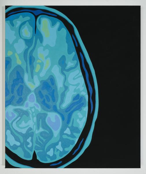 "fMRI" Acrylic Painting